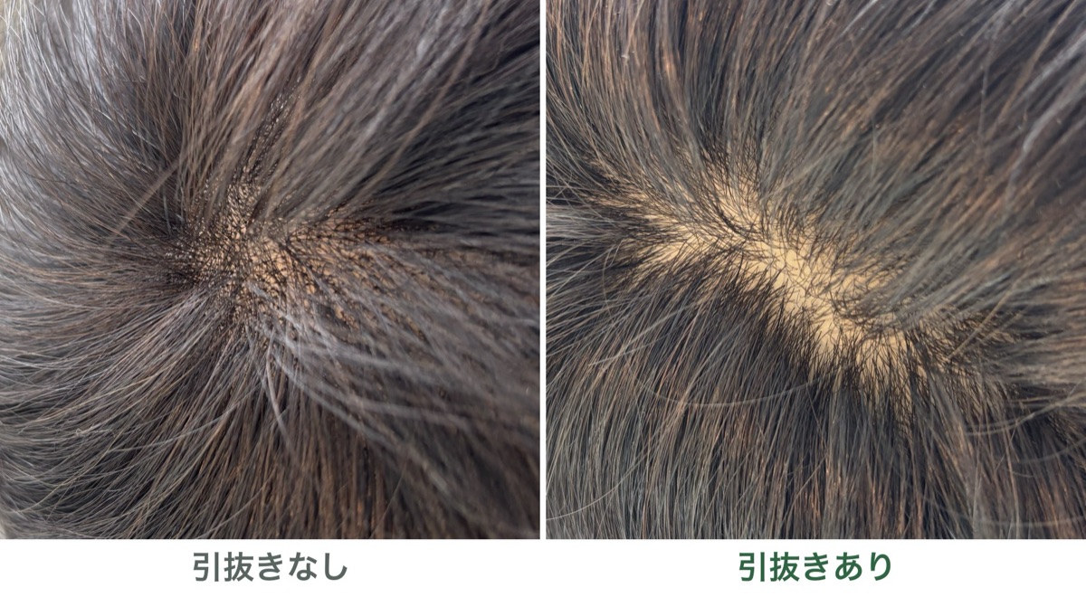 引抜きなしと引抜きありの分け目の比較。引抜きなしは毛の結び目が黒い点々に見え、引抜きありは結び目が見えず肌が透けて自然