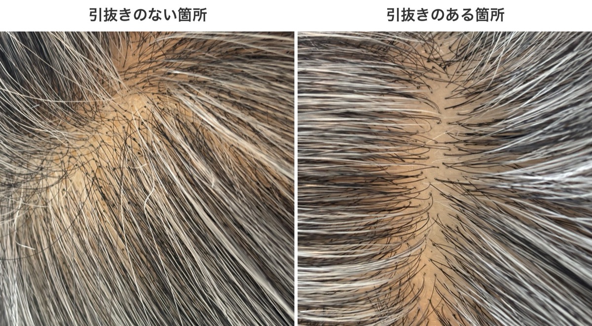 ホールスキン（引抜き）製品の比較。引抜きのない箇所は結び目の黒い点が見え、引抜きのある箇所は結び目が見えず肌から生えているように見える